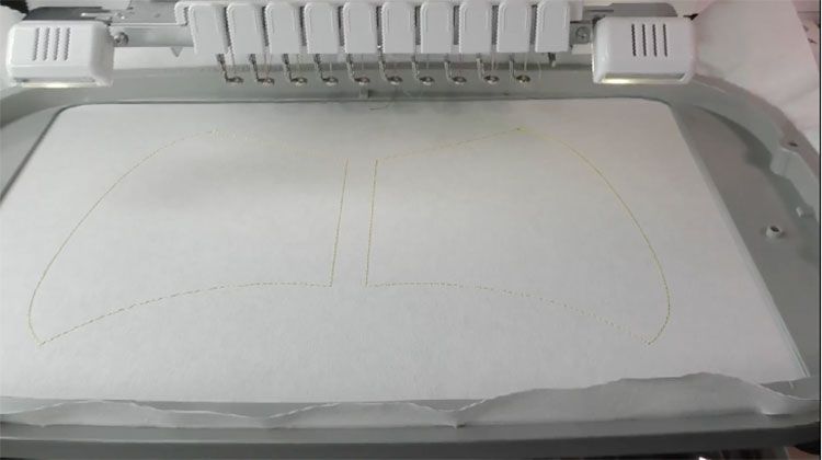 placement stitches